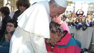 Man with disfigured face whose embrace with Pope Francis touched the world dies