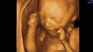 Seven myths about overturning Roe v. Wade