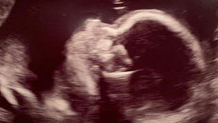 Colorado bishops urge Coloradans to vote yes on late-term abortion ban in November