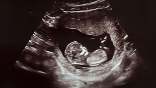 Pray for an end to "Roe v. Wade" at national prayer event