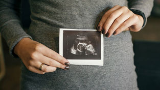 CSU Students for Life push back against student government’s ‘pro-abortion’ resolution