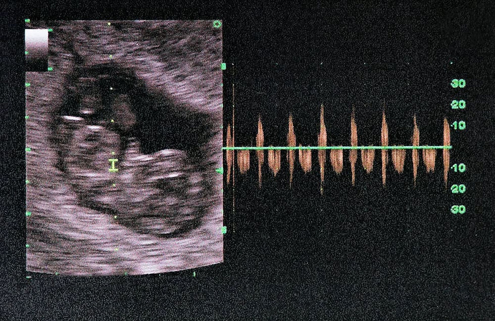 picture of Ultrasound of baby in mother's womb. 24 week.