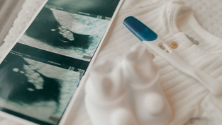 Ultrasound prints and a pregnancy test on a white baby onesie, creating a soft, hopeful pregnancy announcement mood.