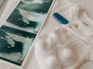 Ultrasound prints and a pregnancy test on a white baby onesie, creating a soft, hopeful pregnancy announcement mood.