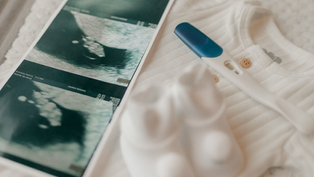 Ultrasound prints and a pregnancy test on a white baby onesie, creating a soft, hopeful pregnancy announcement mood.