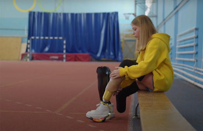 Girl adjusting her prosthetic leg